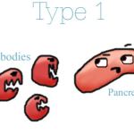 Type 1 Diabetes: A Guide from Little Sister