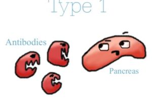 Type 1 Diabetes: Antibodies